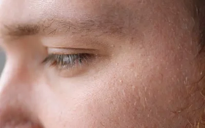 J’ai des points blanchâtres sur les paupières : que puis-je faire ?