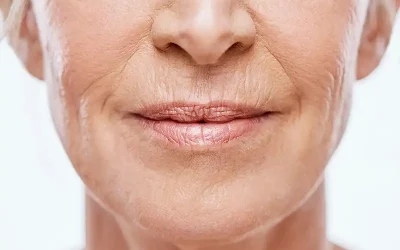 J’ai des rides autour de la bouche : que faire ?