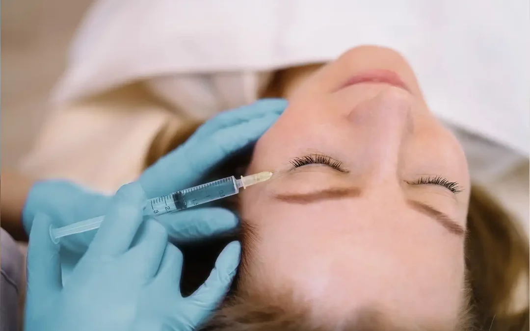 Botox : traitement des rides d’expression