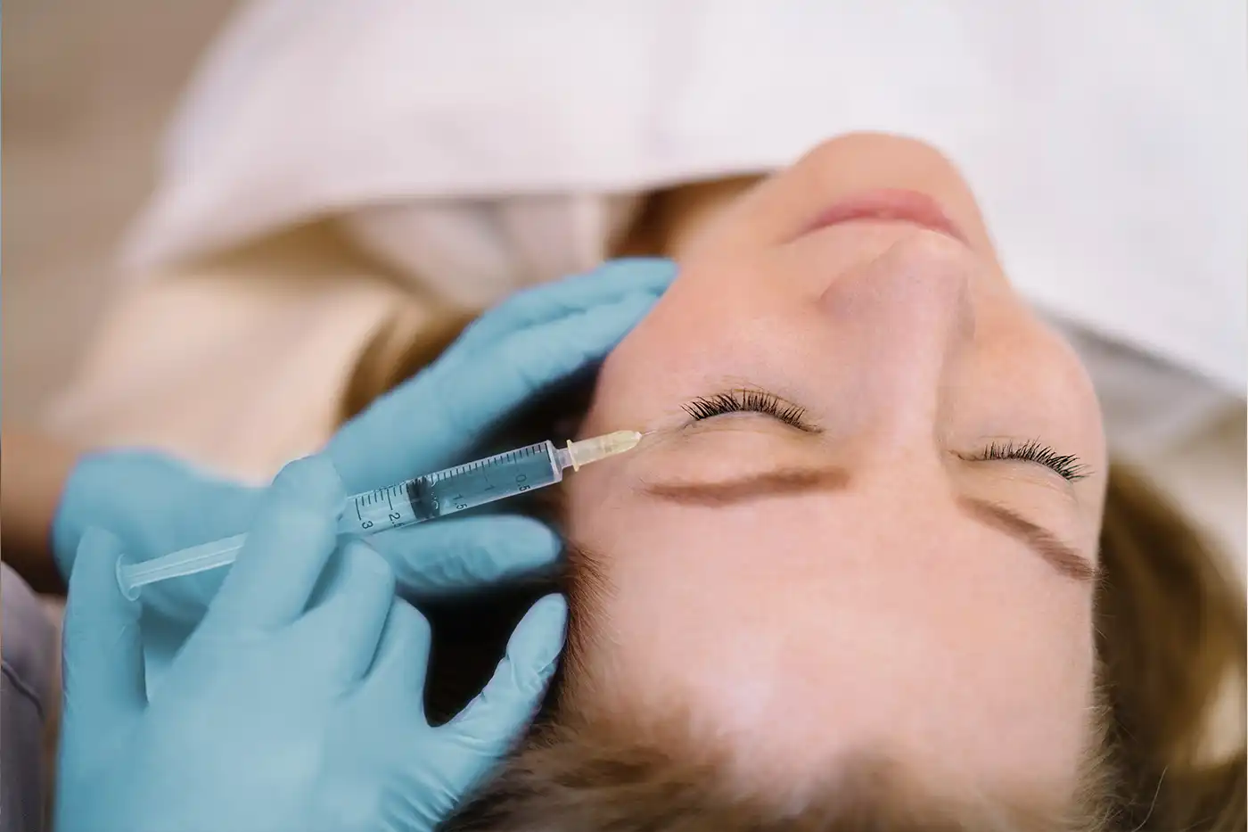 injection botox rides d'expression