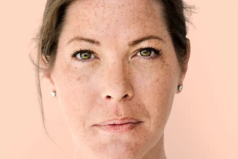 tache solaires sur la peau